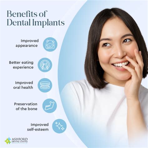 dental implants in ashford